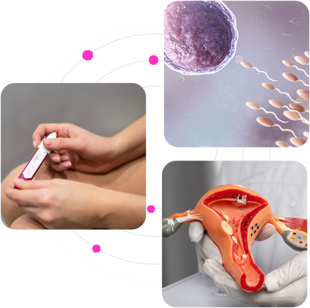 IUI treatment