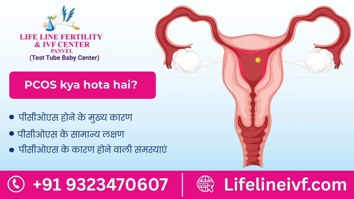 PCOS kya hota hai