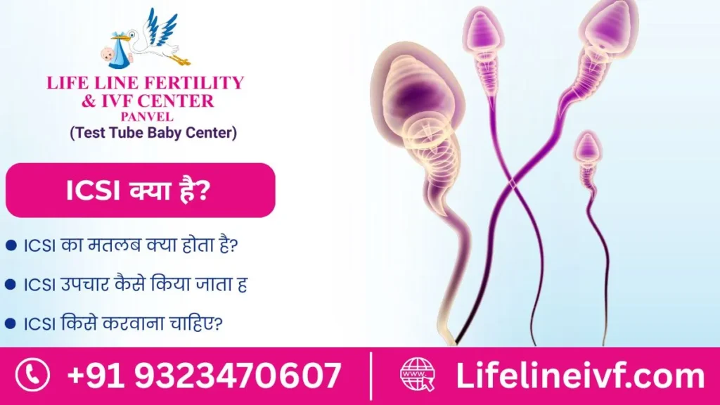 icsi kya hai