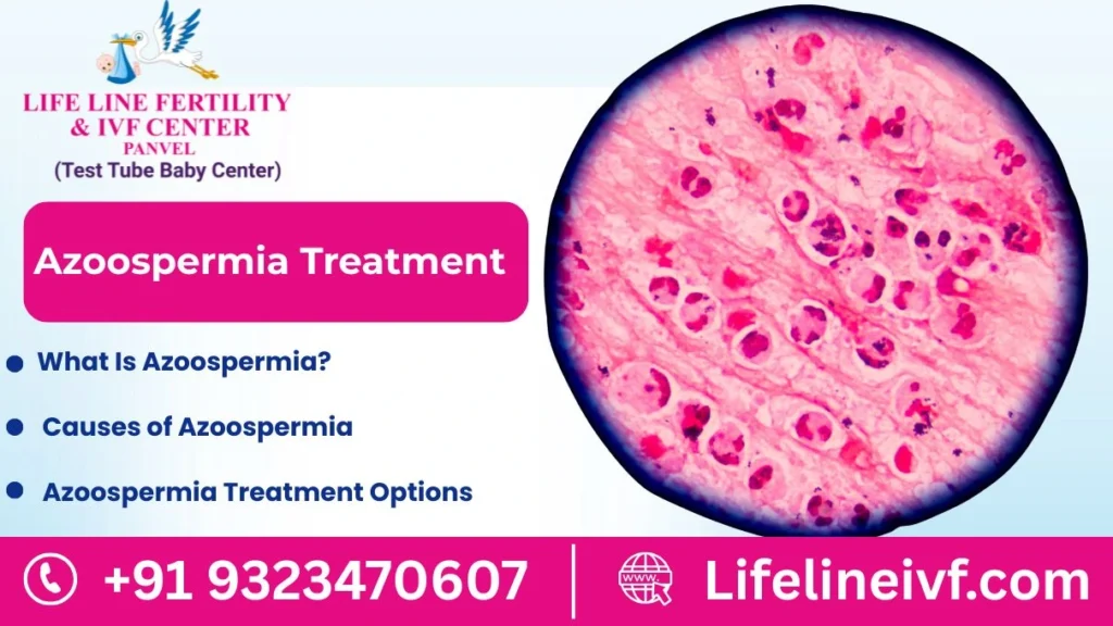 Azoospermia Treatments